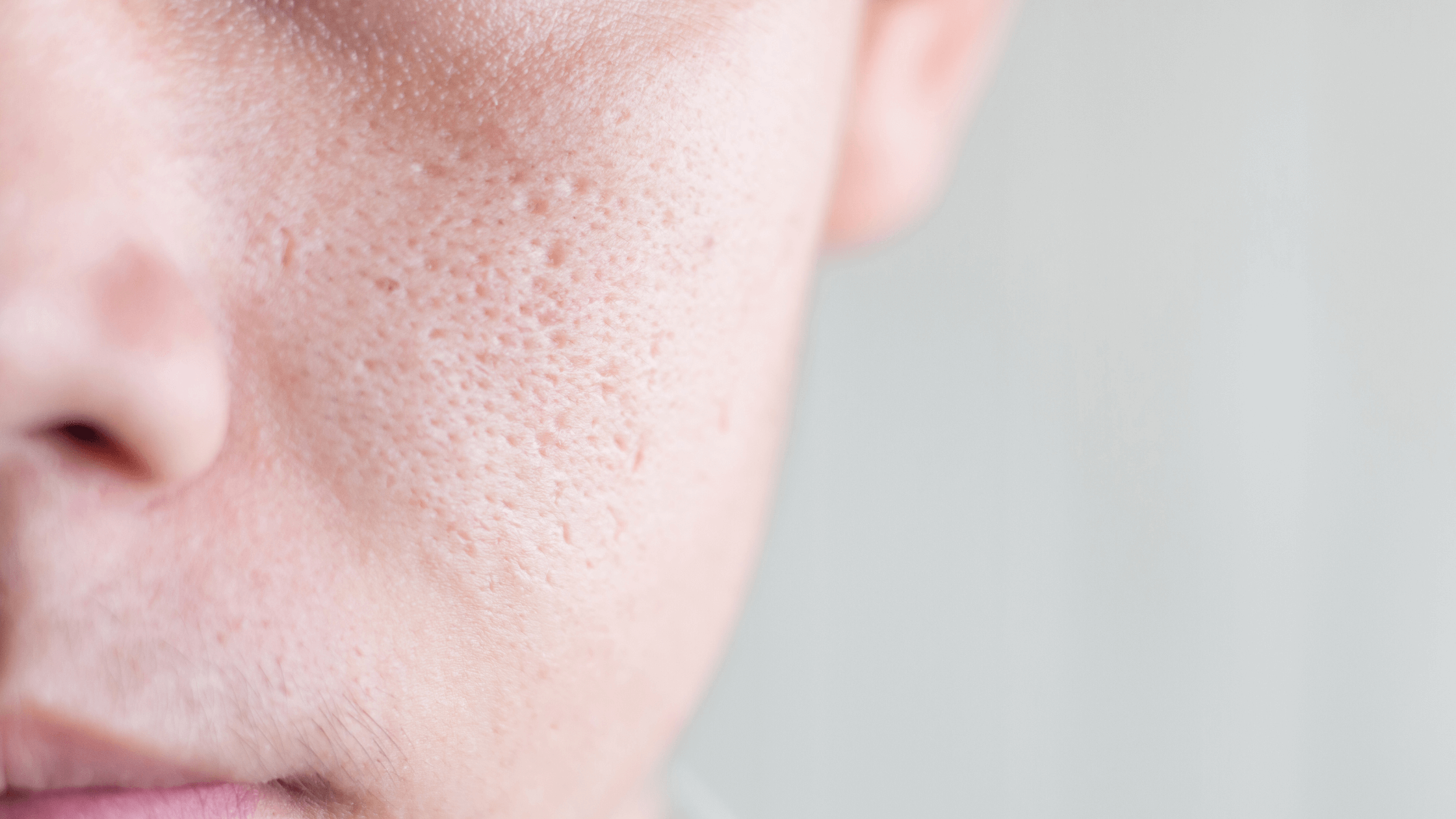 How To Shrink Your Pores